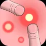 Pimple Squeeze images